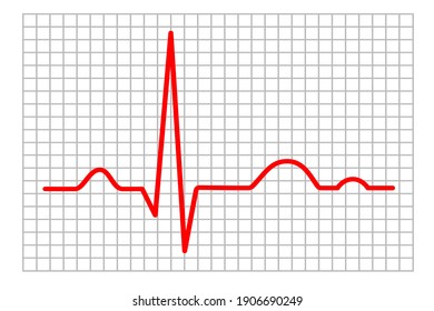 Electrocardiogram Graphic In Vector Quality.