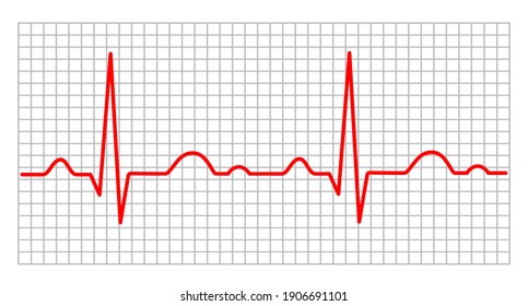 Electrocardiogram Graphic In Vector Quality.