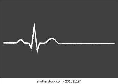 Electrocardiogram Last Life Sign On Blackboard