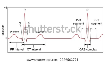 Electrocardiogram: A normal tracing shows the P wave, QRS complex, and T wave and the indicated the PR, QT, QRS, and ST intervals, plus the P-R and S-T are the segments [[stock_photo]] © 