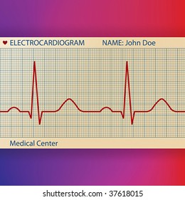 Papel electrocardiográfico con línea gráfica ECG normal