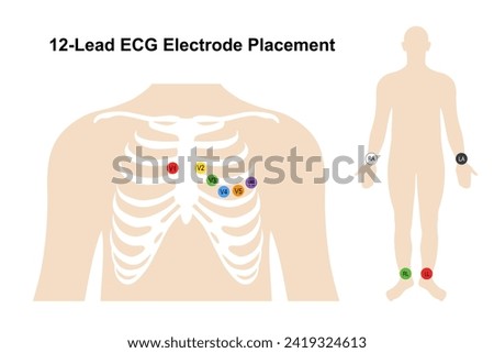 Electrocardiogram. Placement of 12-lead ECG electrodes on the human chest and body. Heart cardiogram. Vector illustration in flat style isolated on white background