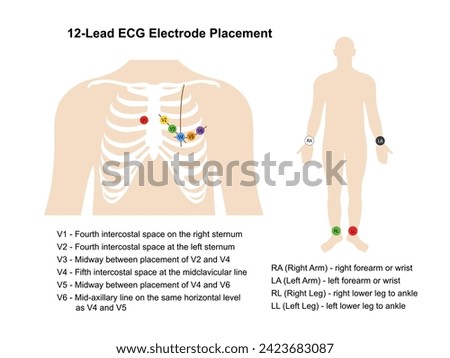 Electrocardiogram. Placement of 12-lead ECG electrodes on the human chest and body with main parts labeled. Heart cardiogram. Vector illustration in flat style isolated on white background