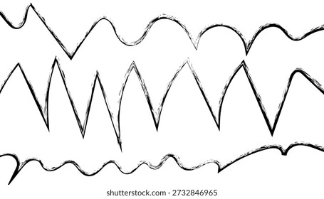An electrocardiogram printout showing abnormal heart rhythms and irregularities in the cardiac waveform