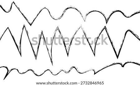 An electrocardiogram printout showing abnormal heart rhythms and irregularities in the cardiac waveform