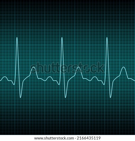 Electrocardiogram seamless background. Heart beat rate ekg recording neon line on blue screen. Examination of human health, medicine test cardiac rhythm. Vector design for hospital page, banner