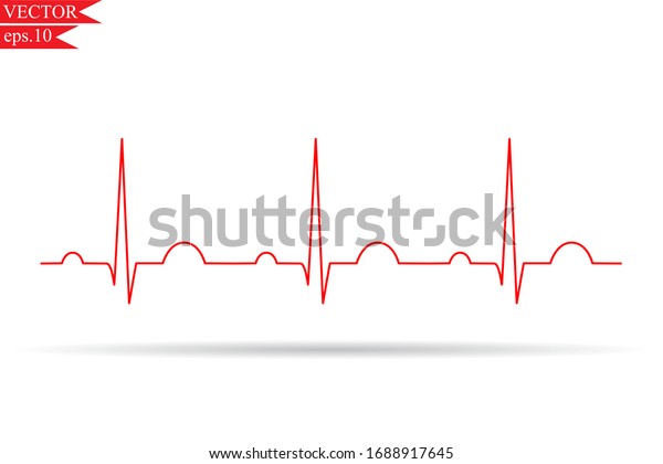 cardiograph bpm normal