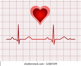 Electrocardiogram track of human heart