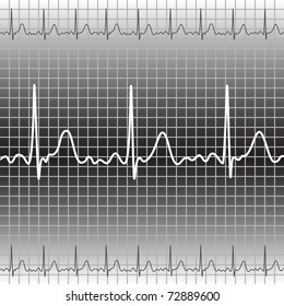 Electrocardiogram, vector illustration, eps10