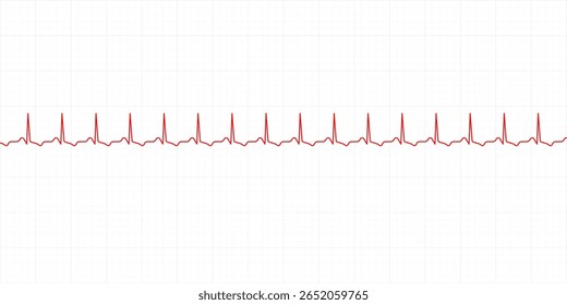 Electrocardiography heartbeat line monitor. Ecg