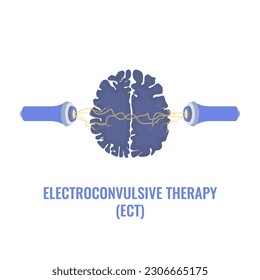 Electroconvulsive therapy for severe depression and schizophrenia treatment. ECT electrodes placement. Brain stimulation equipment for bipolar and major depressive disorders. Vector illustration.