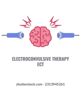 Terapia electroconvulsiva para depresión severa y tratamiento de esquizofrenia. Colocación de electrodos ECT. Equipo de estimulación cerebral para trastornos bipolares y depresivos mayores. Ilustración vectorial.