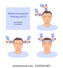 Electroconvulsive therapy for severe depression and schizophrenia treatment. ECT electrodes placement. Brain stimulation equipment for bipolar and major depressive disorders. Vector illustration.