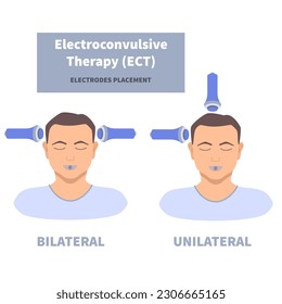 Electroconvulsive therapy for severe depression treatment. ECT electrodes placement on male patient. Brain stimulation equipment for bipolar and major depressive disorders. Vector medical illustration