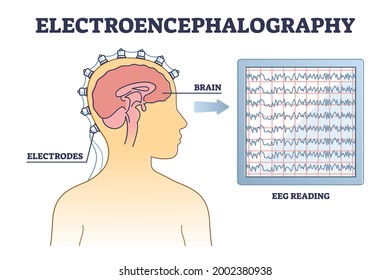 Electroencephalography or EEG as brain activity monitoring outline diagram. Medical health examination with electrodes and reading monitor vector illustration. Head measurement process explanation.