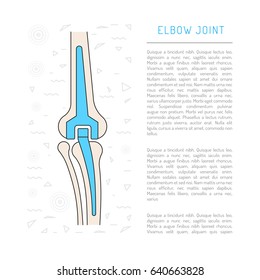 Elimination of pain in the elbow joint through a surgery to replace an elbow joint prosthesis
