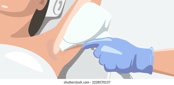 Elos epilation, hair removal procedure on a woman’s body. Beautician doing laser rejuvenation in a beauty salon. Removing unwanted body hair. vector image