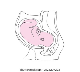 Embryo in ihrem Mutterleib im Mutterbauch, durchgehende Linienzeichnung. Antenatale Kindentwicklung in der Gebärmutter, Vektorgrafik. Menschliches Jungtier. Gesundheit und Geburt von Babys. Handgemachte Vektor nicht AI.