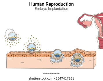 Implantação de embriões Ilustração da reprodução humana. Biologia da anatomia humana.