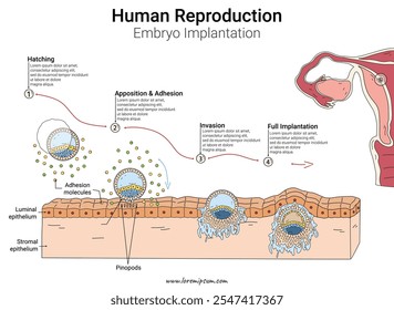 Implantação embrionária Reprodução Humana ilustração com texto. Biologia da anatomia humana.