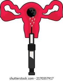 Embryo Transfer Concept, Artificial insemination Vector Icon Design, In Vitro Fertilization Symbol on White Background, Pregnancy and obstetrician Sign, test tube baby procedure stock illustration