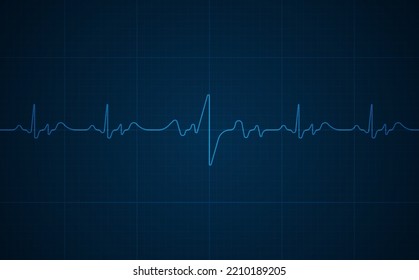 Emergency ekg monitoring. Blue glowing neon heart pulse. Heart beat. Electrocardiogram