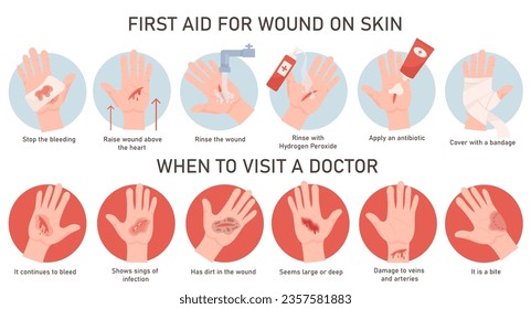 Emergency situation and first aid treatment for wound on hand skin infographic medical poster. Vector illustration rescue procedure to stop bleeding and infection spread, dangerous stage and risk case