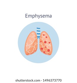 Emphysema Chronic Obstructive Pulmonary Disease Diagram Showing A Cross-section Of Normal Lung And Lungs Damaged By COPD, Vector Illustration Isolated On White Background.
