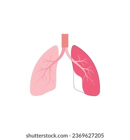 Emphysema Lung Disease Concept Design. Vector Illustration.