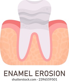 Enamel Erosion Tooth Problem Vector Illustration