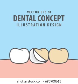 Enamel tooth and whitening illustration vector on blue background. Dental concept.