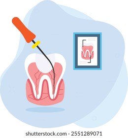 Concepto de tratamiento de conducto radicular, examen dental con sonda y reparación de las cavidades Diseño de íconos de color de Vector, Símbolo de odontología, Signo de atención médica, Instrumento dental Ilustración de stock