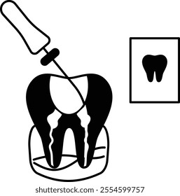 Endodontic therapy Root canal treatment Concept, dental examination with Probe and Repair cavities vector outline design, Odontology symbol, manual dexterity sign Dentist tools stock illustration