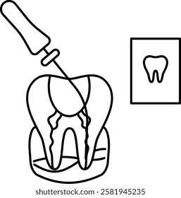 Endodontic therapy Root canal treatment Concept, dental examination with Probe and Repair cavities vector icon design, Dentistry symbol, Healthcare sign, Dental instrument illustration