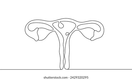 Endometrial polyps inside the uterus. Disease of the female reproductive system. Benign formation inside the uterine cavity. Images produced without the use of any form of AI software at any stage. 