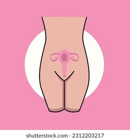 Endometriosis con estado de salud el endometrio crece fuera de la pared uterina en mujeres para tratamiento con mano de caricatura plana dibujando plantillas Ilustración