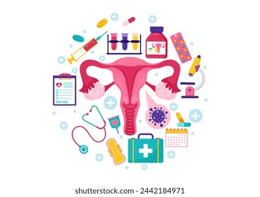 Endometriosis Vector Illustration with Condition the Endometrium Grows Outside the Uterine Wall in Women for Treatment in Flat Cartoon Background