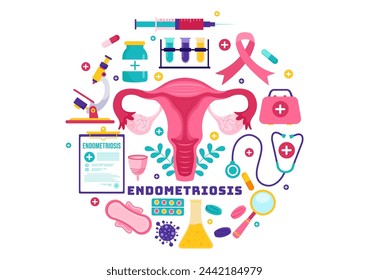 Endometriosis Vector Illustration with Condition the Endometrium Grows Outside the Uterine Wall in Women for Treatment in Flat Cartoon Background