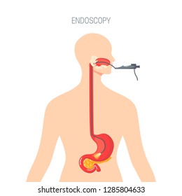 Endoscopy diagnostic concept. Caucasian woman getting endoscopic examination. Vector illustration in flat style.