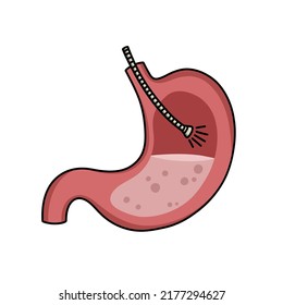 Endoscopy Doodle Icon, Vector Illustration