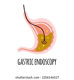 Endoscopy. The stomach of a person with high acidity. Gastroenterology. Vector illustration in a flat 