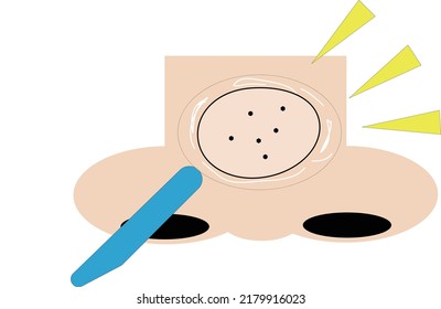Enlarged illustration of nose pore dirt