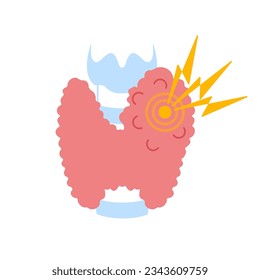 Enlarged thyroid gland lobe. Goiter icon. Thyroid hormones function imbalance. Endocrine system disease. Hyperthyroidism and hypothyroidism. Overactive organ. Isolated flat vector illustration.