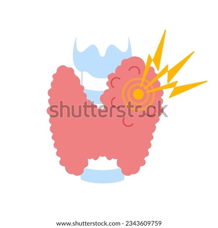 Enlarged thyroid gland lobe. Goiter icon. Thyroid hormones function imbalance. Endocrine system disease. Hyperthyroidism and hypothyroidism. Overactive organ. Isolated flat vector illustration.