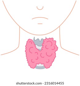 Enlarged thyroid gland lobe icon. Faceless body silhouette. Thyroid hormones function support. Hyperthyroidism and hypothyroidism diseases. Metabolism control. Body anatomy. Vector illustration.