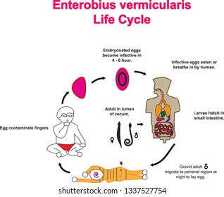 Enterobius vermicularis - Wikipedia