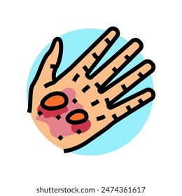 epidermolysis bullosa disease color icon vector. epidermolysis bullosa disease sign. isolated symbol illustration