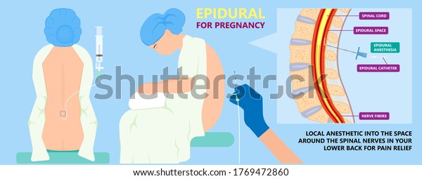 Epidural spinal block anaesthesia Pinched relieve\
General vaginal medical steroid Natural surgery Walking opioids\
baby pain back cord birth labor women local spine space relief\
labour section giving