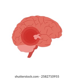 Epilepsy, Disability Vector Illustration Isolated