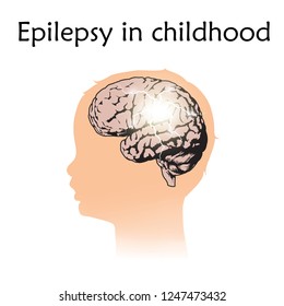 Epilepsy In Infants, Childhood. Vector Medical Illustration. Kid, Baby, Childhood. White Background, Silhouette Of Child Head, Anatomy Flat Image Of Brain, Electrical Discharge.